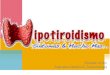 Hipotiroidismo y complicaciones