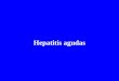 Hepatitis Agudas Uqi
