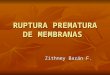 RUPTURA PREMATURA DE MEMBRANA