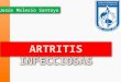 Artritis infecciosas