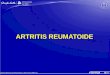 Artritis reumatoide[1]