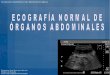 Ecografia organos abdominales Curso Eco DSGM 2014