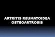 Artritis reumatoidea