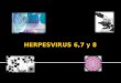 Herpes 6,7 y 8
