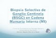 Biopsia selectiva de ganglio centinela en cadena mamaria interna