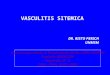 (5) vasculitis