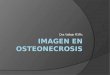Imagen en osteonecrosis