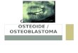 Osteoma osteoide