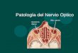 Patología Del Nervio Optico