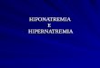 HIPONATREMIA E HIPERNATREMIA