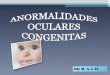 Anormalidades oculares en pediatria