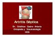 Artritis septica