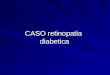 CASO de retinopatia diabetica
