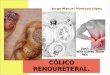 colico renoureteral