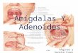 Amigdalas y Adenoides