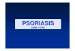 Psoriasis guttata 4