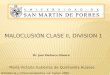 MALOCLUSIÓN CLASE II, DIVISION I