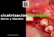 cicatrizacion tejidos orales