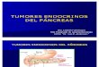 Tumores Endocrinos Del Pancreas