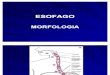 Esofago - Barret. Cancer