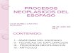 Procesos Neoplasicos Del Esofago