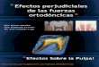 Biomecánica en Ortodoncia