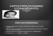 hipotiroidismo congenito JN