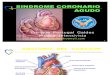 EKG6 Síndrome Coronario Agudo