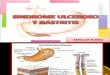 Sindrome Ulceroso y Gastritis