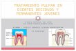 Endodoncia en Dientes Deciduos & Permanentes