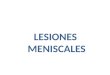 LESIONES  MENISCOS 3