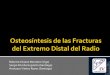 Osteosintesis Fracturas Extremo Distal Del Radio