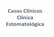 Casos Clinicos de Clinica Estomatologica