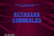 Ectaseas Corneales
