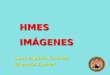 Práctica 5 " HMES imágenes"