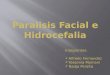 Paralisis facial e hidrocefalia