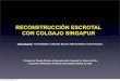 RECONSTRUCCIÓN ESCROTAL CON COLGAJO SINGAPUR