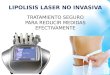 Lipolisis laser