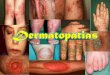 Dermatitis y tineas