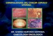 Generalidades del cancer cervico uterino