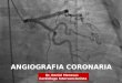 Angiografia coronaria