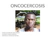 Oncocercosis y Paludismo
