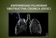 Enfermedad pulmonar obstructiva cronica (epoc)
