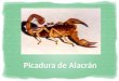 Picadura de Alacrn