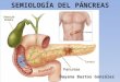 Semiologia de pancreas