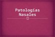 Patologías Nasales