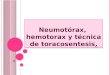 Neumotorax, hemotorax y toracosentesis