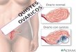 Quistes ovaricos pend(2)