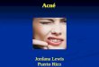 2013 Puerto Rico acne spn