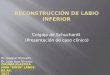 Reconstrucción Labio Inferior. Dr. Gaspar Marcello